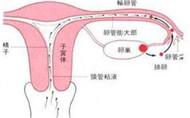 输卵管堵塞的症状有哪些？